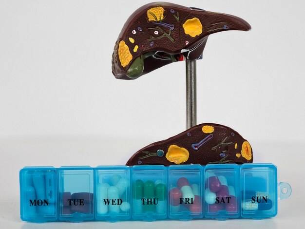 Kamienie w pęcherzu żółciowym objawy które powinny zwrócić Twoją uwagę