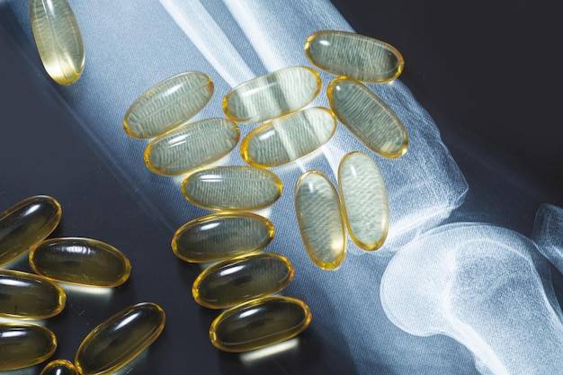 Kapsułki na stawy i kości Flexi Vit Kolagen bezglutenowe – czy warto je wybrać?